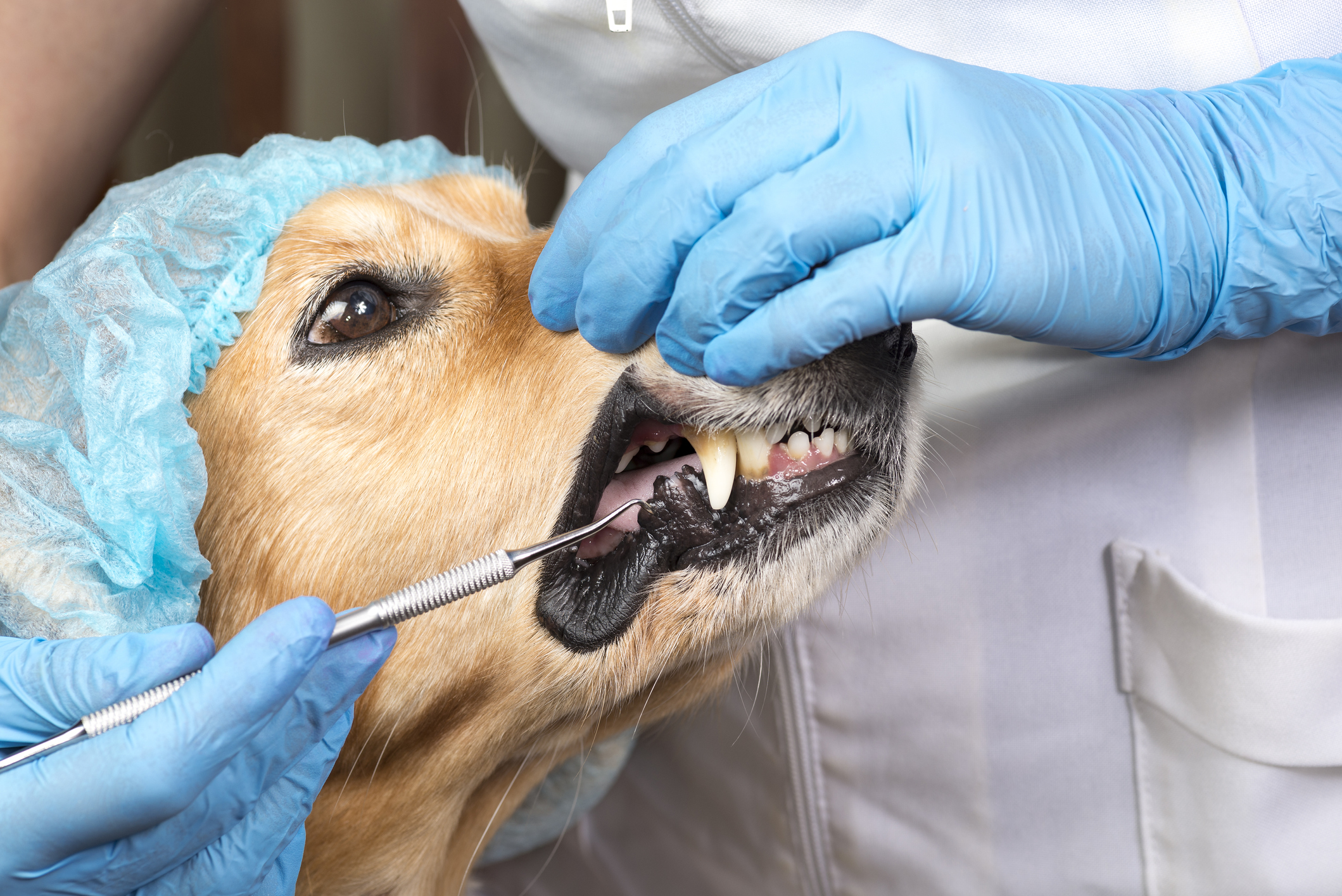 Limpieza dental